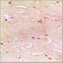 product-image-AAA17820_IHC2.jpg