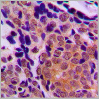product-image-AAA17821_IHC2.jpg