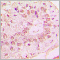 product-image-AAA17822_IHC2.jpg