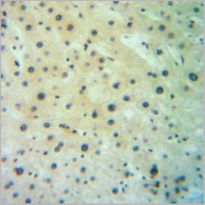 product-image-AAA17823_IHC2.jpg