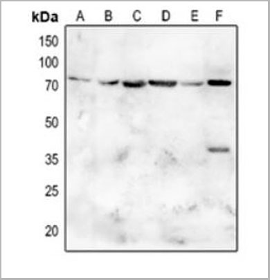 product-image-AAA17823_WB.jpg