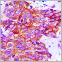 product-image-AAA17824_IHC2.jpg