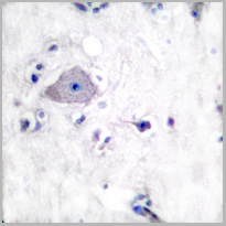 product-image-AAA17825_IHC3.png