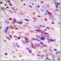 product-image-AAA17826_IHC2.jpg