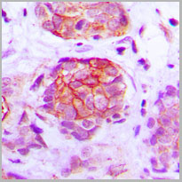 product-image-AAA17827_IHC2.jpg