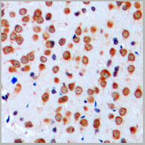 product-image-AAA17829_IHC2.jpg