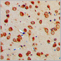 product-image-AAA17830_IHC2.jpg