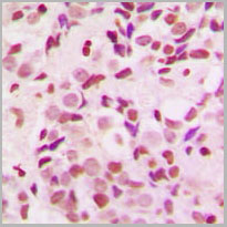 product-image-AAA17832_IHC2.jpg