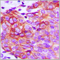 product-image-AAA17833_IHC2.jpg