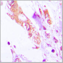 product-image-AAA17834_IHC2.jpg