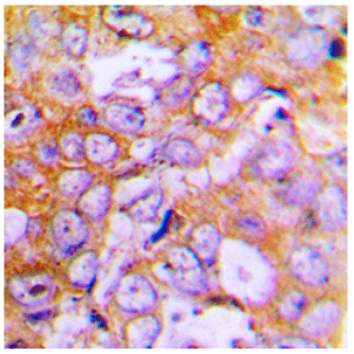 product-image-AAA17835_IHC2.jpg