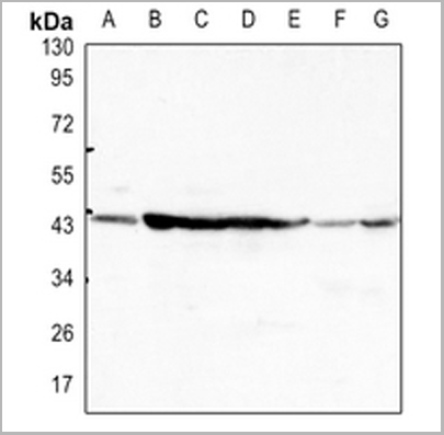 product-image-AAA17835_WB.png