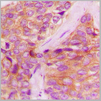 product-image-AAA17836_IHC2.jpg