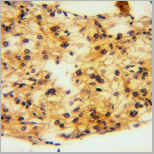 product-image-AAA17837_IHC2.png