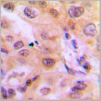 product-image-AAA17839_IHC2.jpg
