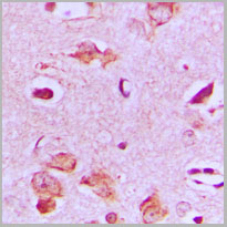 product-image-AAA17840_IHC2.jpg