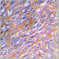 product-image-AAA17841_IHC2.jpg