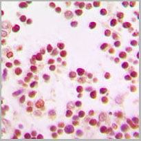 product-image-AAA17842_IHC2.jpg