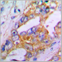 product-image-AAA17845_IHC2.jpg