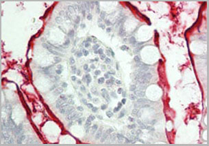 product-image-AAA17846_IHC2.jpg