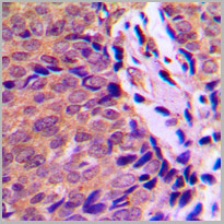 product-image-AAA17914_IHC2.jpg