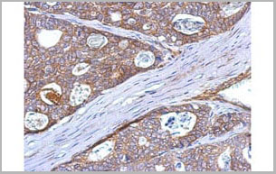 product-image-AAA17934_IHC.jpg