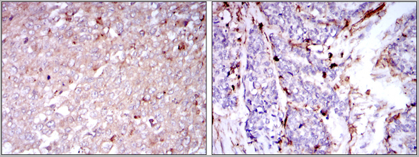 product-image-AAA17955_IHC2.jpg