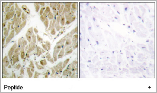 product-image-AAA17963_IHC.jpg