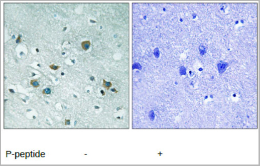 product-image-AAA17969_IHC.jpg