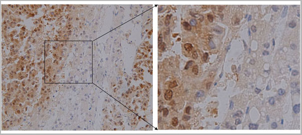 product-image-AAA17979_IHC.jpg