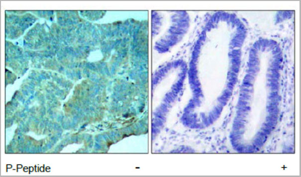 product-image-AAA17980_IHC.jpg