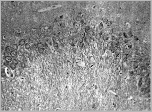 product-image-AAA17984_IHC2.jpg