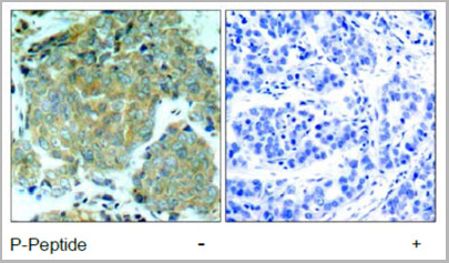 product-image-AAA17986_IHC.jpg