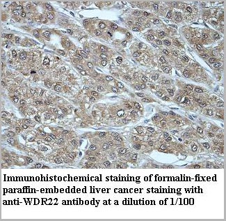 product-image-AAA18000_IHC2.jpg