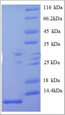 product-image-AAA18404_SDS_PAGE.jpg