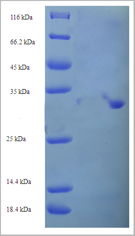 product-image-AAA18408_SDS_PAGE.png