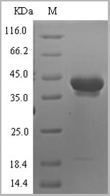 product-image-AAA18416_SDS_PAGE.jpg