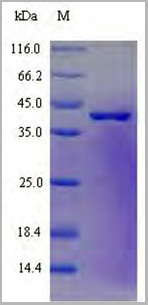 product-image-AAA18512_SDS_PAGE.jpg
