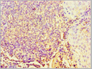 product-image-AAA18534_IHC3.jpg