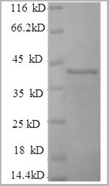 product-image-AAA18590_SDS_PAGE2.jpg