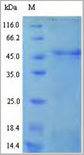 product-image-AAA18601_SDS_PAGE.jpg