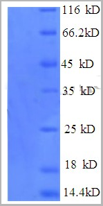 product-image-AAA18688_SDS_PAGE.png