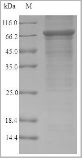 product-image-AAA18771_SDS_PAGE.png