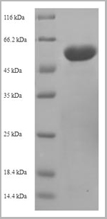 product-image-AAA18787_SDS_PAGE.jpg
