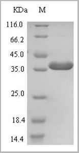 product-image-AAA18791_SDS_PAGE.jpg