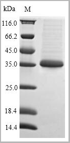 product-image-AAA18797_SDS_PAGE.png