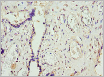 product-image-AAA18802_IHC3.jpg