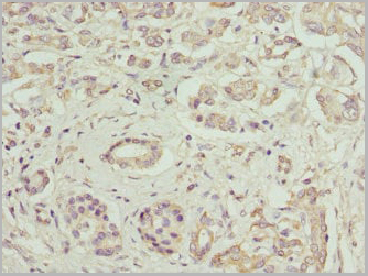 product-image-AAA18802_IHC4.jpg