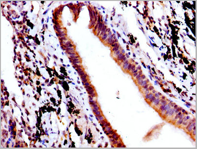 product-image-AAA18802_IHC7.png