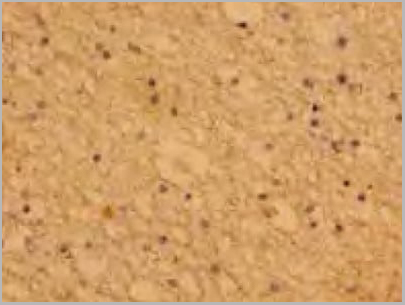product-image-AAA18805_IHC.jpg